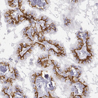 Anti-LEPR Antibody