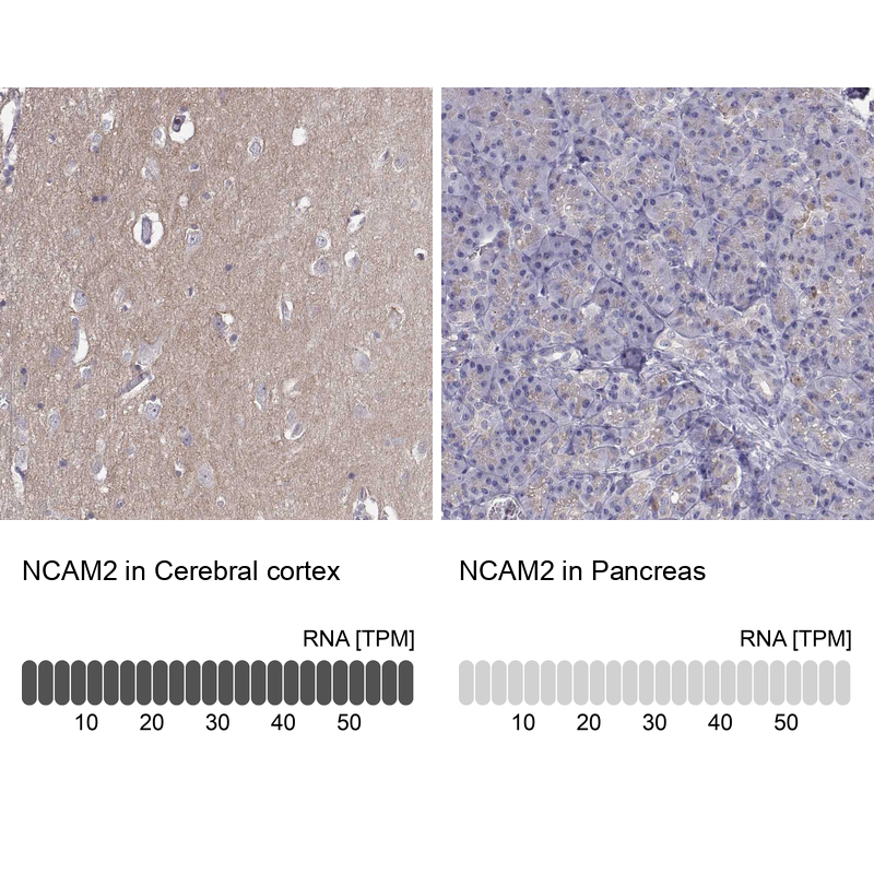Anti-NCAM2 Antibody