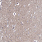 Immunohistochemical staining of human cerebral cortex shows moderate membranous positivity in neuropil.