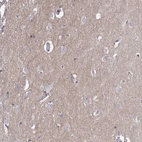 Immunohistochemical staining of human cerebral cortex shows moderate membranous positivity in neuropil.