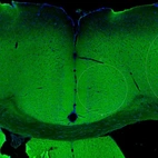 Immunohistochemical staining of mouse cerebral cortex shows moderate membranous positivity in neuropil.
