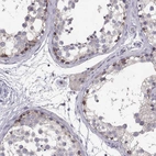Immunohistochemical staining of human testis shows moderate membranous positivity in cells in seminiferous ducts.
