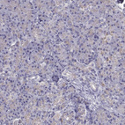 Immunohistochemical staining of human pancreas shows no membranous positivity in exocrine glandular cells as expected.