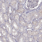 Immunohistochemical staining of human kidney shows no membranous positivity in cells in tubules as expected.