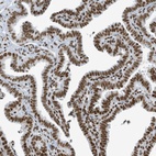 Anti-SARNP Antibody