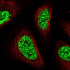 Immunofluorescent staining of human cell line U-2 OS shows localization to nuclear speckles.