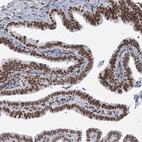 Anti-SARNP Antibody