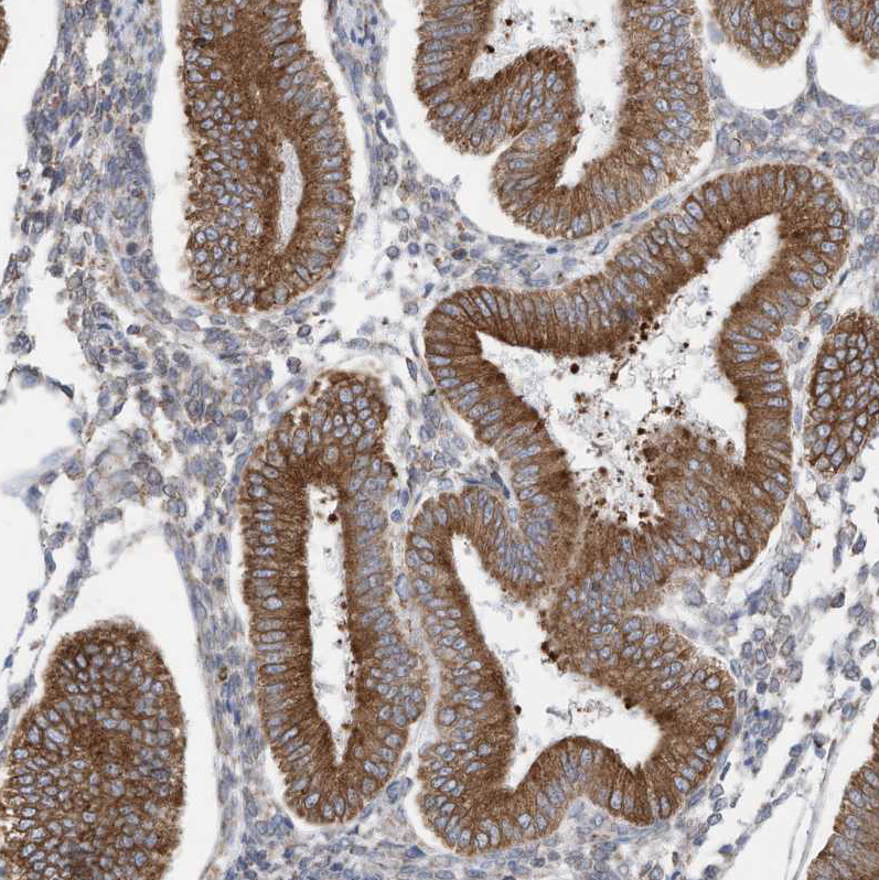 Anti-ZNF354C Antibody
