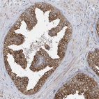 Immunohistochemical staining of human prostate shows moderate cytoplasmic positivity in glandular cells.