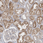 Anti-ZNF354C Antibody