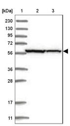 Anti-ZNF354C Antibody