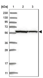 Lane 1: Marker [kDa] 230, 130, 95, 72, 56, 36, 28, 17, 11_br/_Lane 2: Human cell line RT-4_br/_Lane 3: Human cell line U-251MG sp