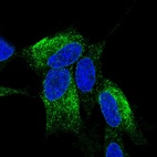 Immunofluorescent staining of human cell line SH-SY5Y shows localization to nuclear membrane & cytosol.