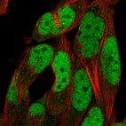 Anti-ADAMTS5 Antibody