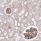 Anti-ZNF843 Antibody