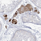 Anti-ZNF843 Antibody