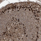 Immunohistochemical staining of human tonsil shows moderate to strong cytoplasmic positivity in lymphoid cells.