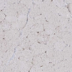 Immunohistochemical staining of human skeletal muscle shows no cytoplasmic positivity in striated muscle fibers as expected.