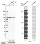 Western blot analysis in human cell lines SK-MEL-30 and U-251MG using Anti-MX1 antibody. Corresponding MX1 RNA-seq data are presented for the same cell lines. Loading control: Anti-PPIB.