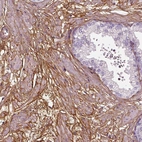 Immunohistochemical staining of human prostate shows strong membranous positivity in smooth muscle cells.