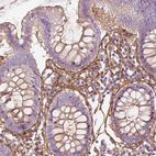 Immunohistochemical staining of human colon shows strong positivity in extracellular matrix in lamina propria.