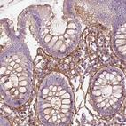 Immunohistochemical staining of human colon shows strong positivity in extracellular matrix in lamina propria.