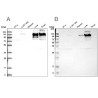 Western blot analysis using Anti-COL6A2 antibody HPA030920 (A) shows similar pattern to independent antibody HPA007029 (B).