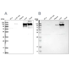 Western blot analysis using Anti-COL6A2 antibody HPA030920 (A) shows similar pattern to independent antibody HPA007029 (B).