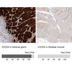 Anti-C2CD2 Antibody