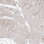 Immunohistochemical staining of human skeletal muscle shows low expression as expected.
