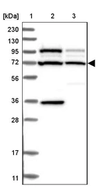 Lane 1: Marker [kDa] 230, 130, 95, 72, 56, 36, 28, 17, 11_br/_Lane 2: Human cell line RT-4_br/_Lane 3: Human cell line U-251MG sp