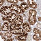 Immunohistochemical staining of human kidney shows strong membranous positivity in cells in tubules.