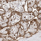 Immunohistochemical staining of human placenta shows strong membranous positivity in trophoblastic cells.