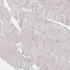 Immunohistochemical staining of human skeletal muscle shows no positivity in myocytes as expected.