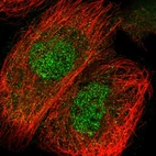 Immunofluorescent staining of human cell line A-431 shows localization to nucleoplasm.