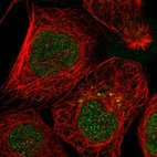 Immunofluorescent staining of human cell line A-431 shows localization to nucleus.