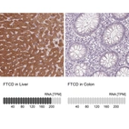 Anti-FTCD Antibody