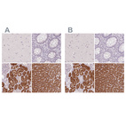 Immunohistochemical staining of human cerebral cortex, colon, kidney and liver using Anti-FTCD antibody HPA030928 (A) shows similar protein distribution across tissues to independent antibody HPA030929 (B).