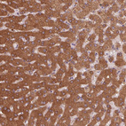 Immunohistochemical staining of human liver shows strong cytoplasmic positivity in hepatocytes.