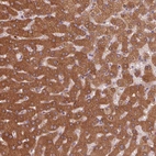 Immunohistochemical staining of human liver shows strong cytoplasmic positivity in hepatocytes.
