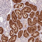 Immunohistochemical staining of human kidney shows strong cytoplasmic positivity in cells in tubules.