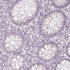 Immunohistochemical staining of human colon shows no cytoplasmic positivity in glandular cells as expected.