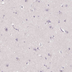 Immunohistochemical staining of human cerebral cortex shows no cytoplasmic positivity in neuronal cells as expected.