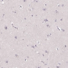 Immunohistochemical staining of human cerebral cortex shows no cytoplasmic positivity in neuronal cells as expected.