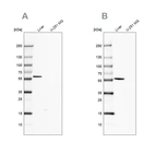 Western blot analysis using Anti-FTCD antibody HPA030928 (A) shows similar pattern to independent antibody HPA030929 (B).