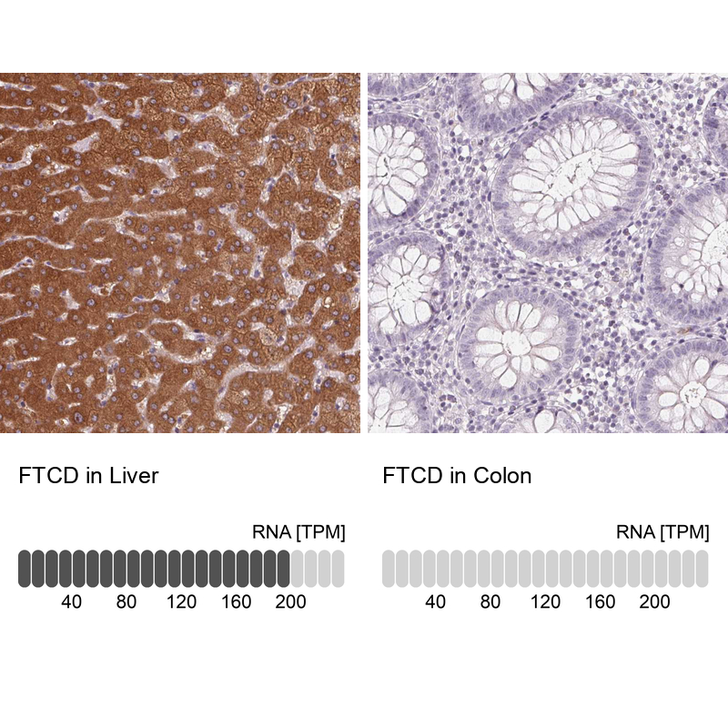 Anti-FTCD Antibody