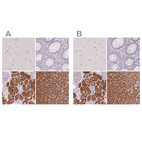 Immunohistochemical staining of human cerebral cortex, colon, kidney and liver using Anti-FTCD antibody HPA030929 (A) shows similar protein distribution across tissues to independent antibody HPA030928 (B).