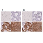 Immunohistochemical staining of human cerebral cortex, colon, kidney and liver using Anti-FTCD antibody HPA030929 (A) shows similar protein distribution across tissues to independent antibody HPA030928 (B).