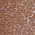 Immunohistochemical staining of human liver shows strong cytoplasmic positivity in hepatocytes.