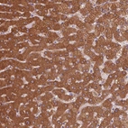 Immunohistochemical staining of human liver shows strong cytoplasmic positivity in hepatocytes.